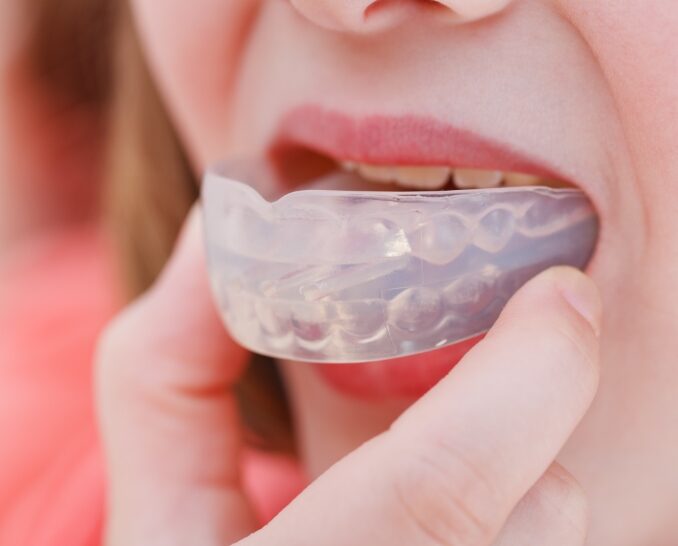 denture-care-clinic-for-all-your-mouthguard-needs