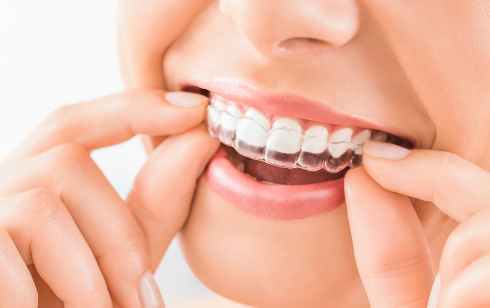 Sports Mouthguards Melbourne Denture Care Clinic